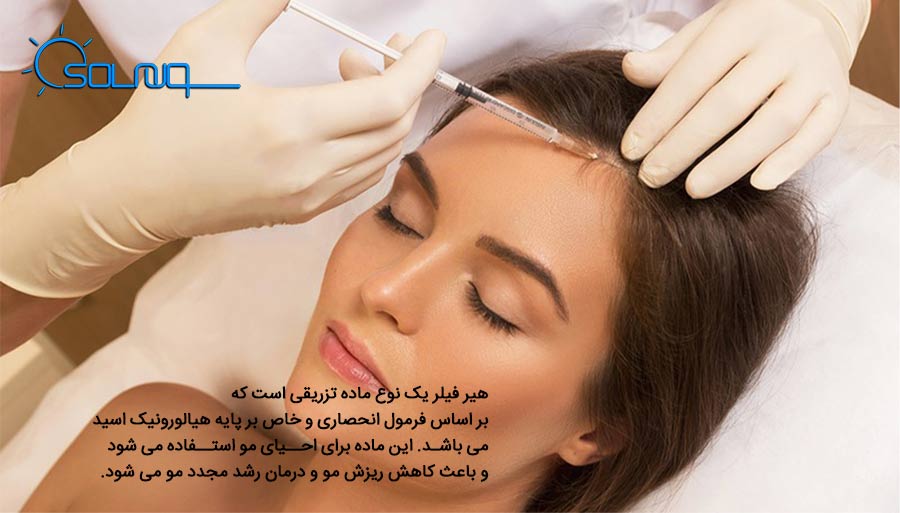 فیلر مو چیست