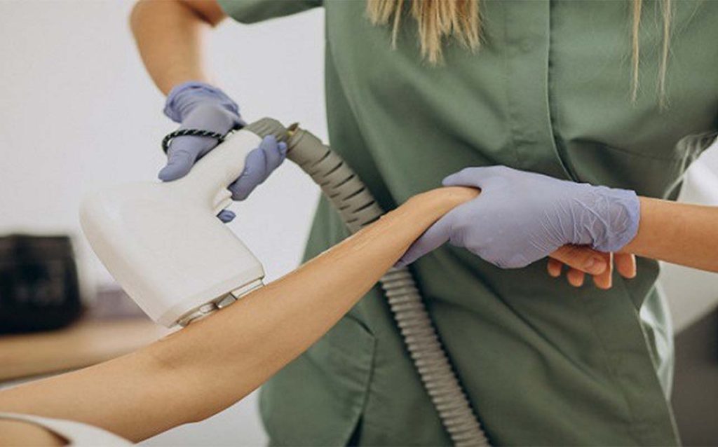 لیزر مو زائد