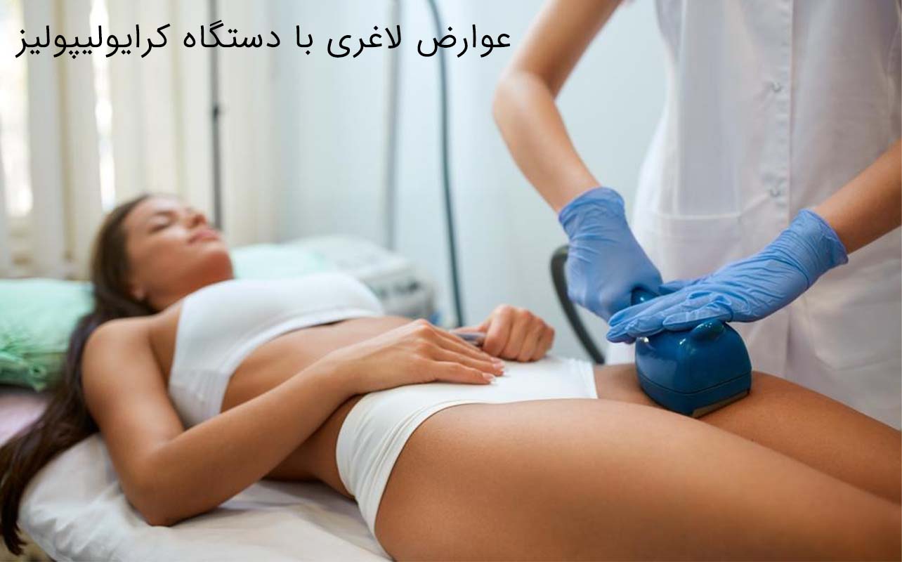هزینه کرایولیپولیز