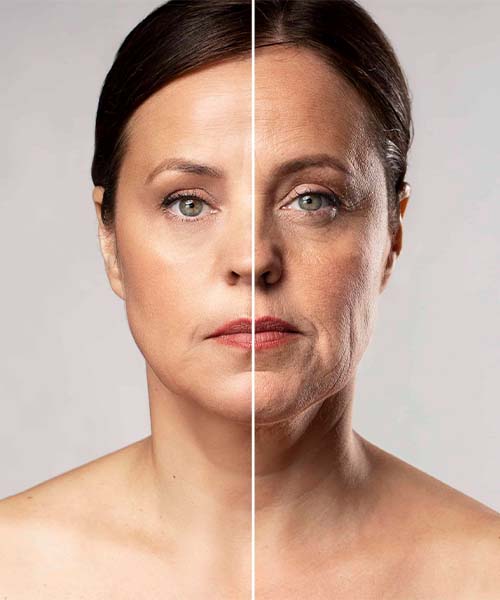 هایفوتراپی