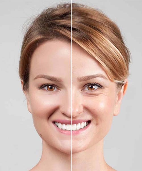 هایفوتراپی