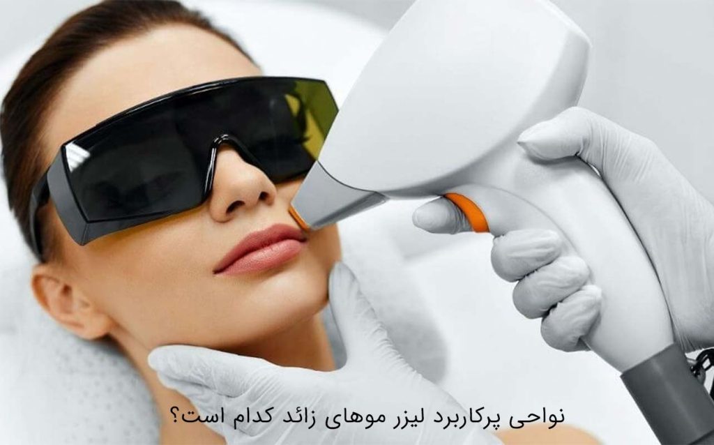 نواحی پرکاربرد لیزر