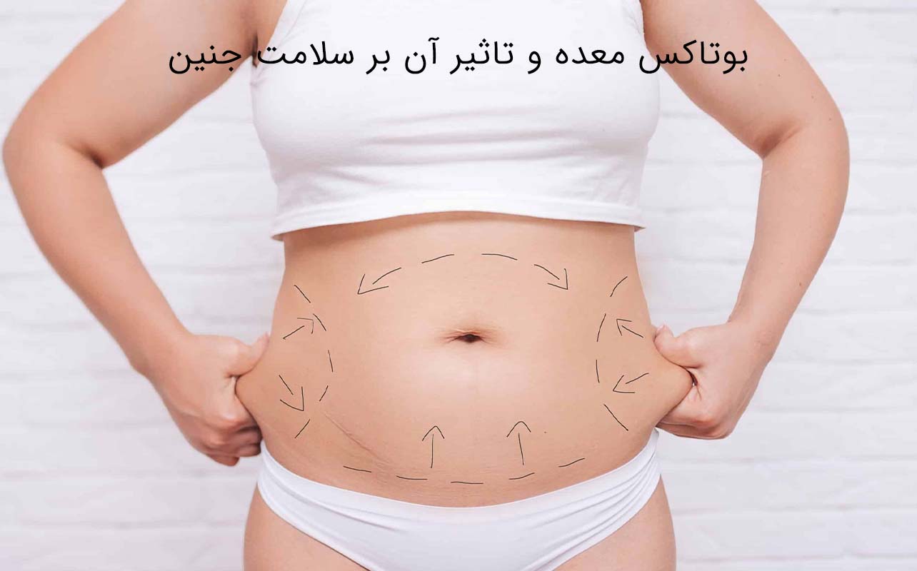 بوتاکس معده و بارداری