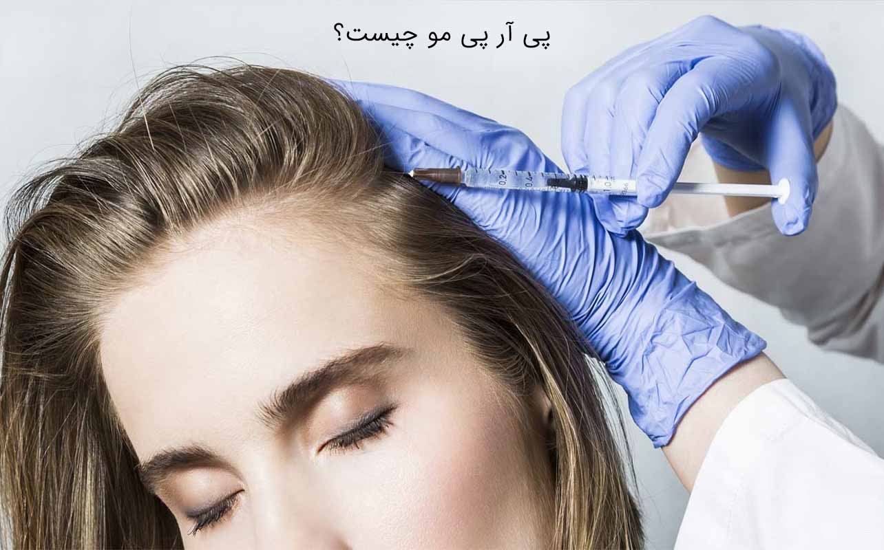 پی آر پی مو چیست؟