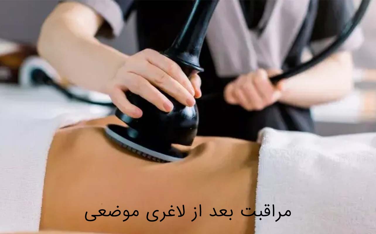 معایب لاغری موضعی
