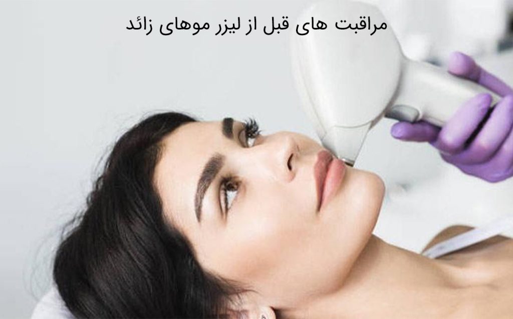 مراقبت بعد از لیزر