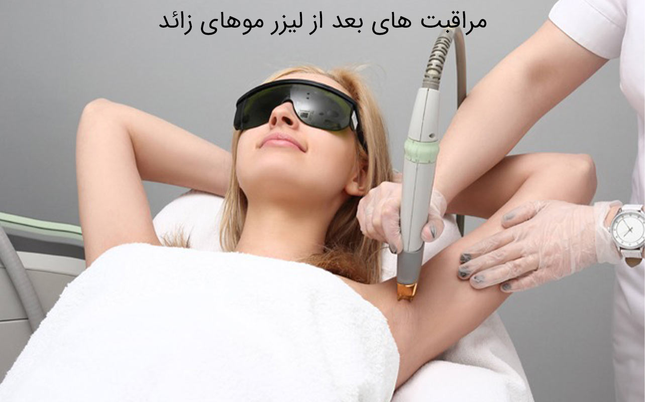 مراقبت قبل از لیزر