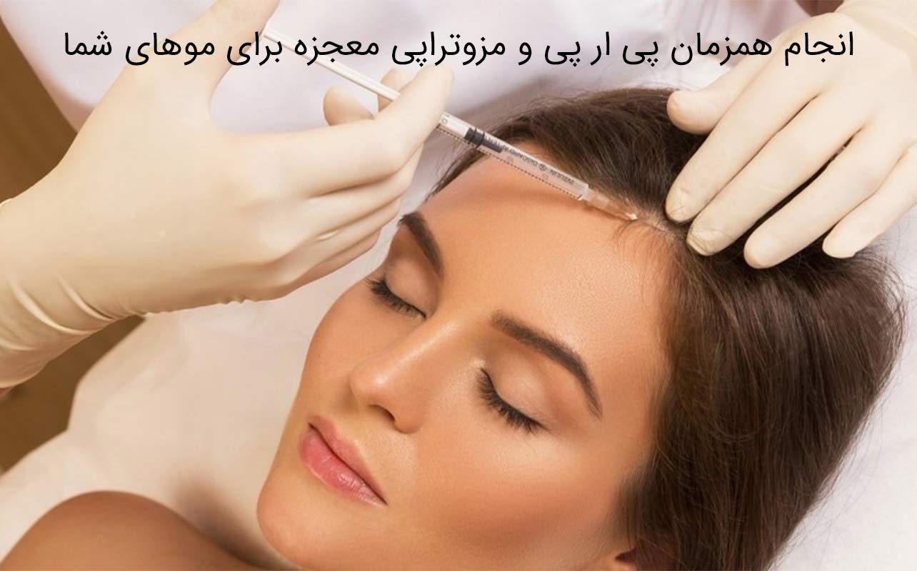 مزوتراپی مو چیست؟