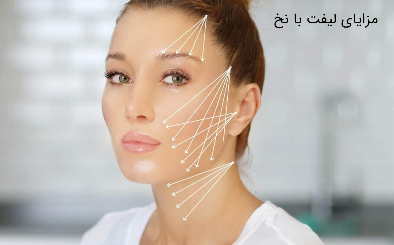 ماندگاری لیفت با نخ