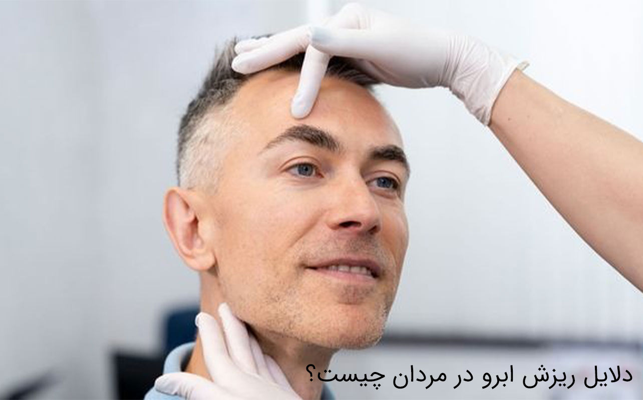 ریزش ابرو در مردان