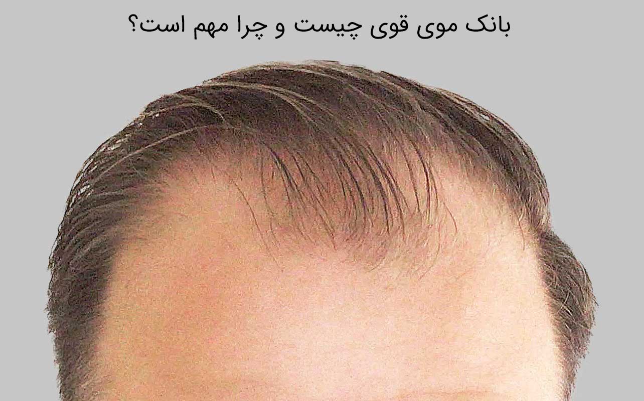 بانک موی قوی