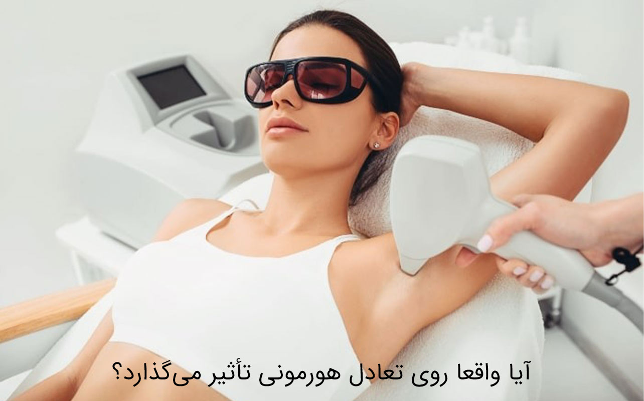 لیزر موهای زائد