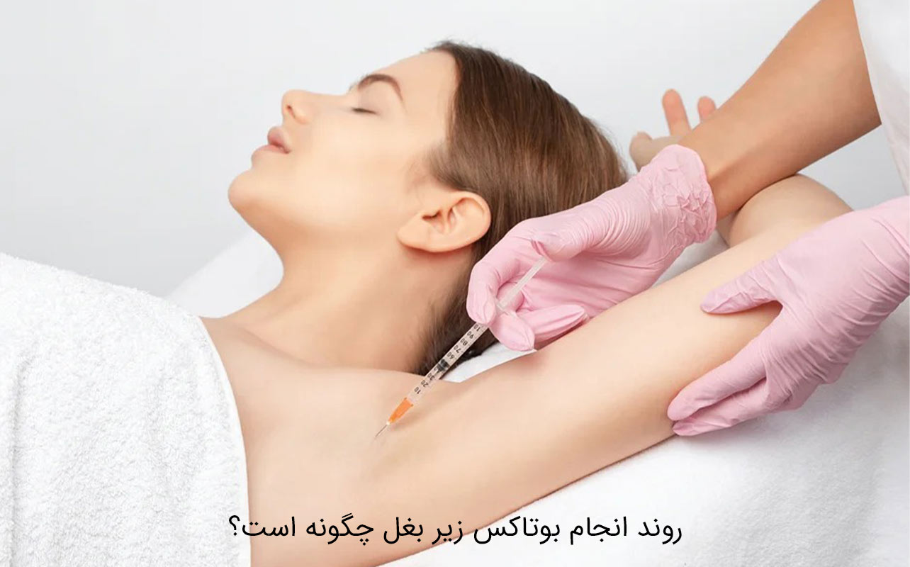 بوتاکس زیر بغل