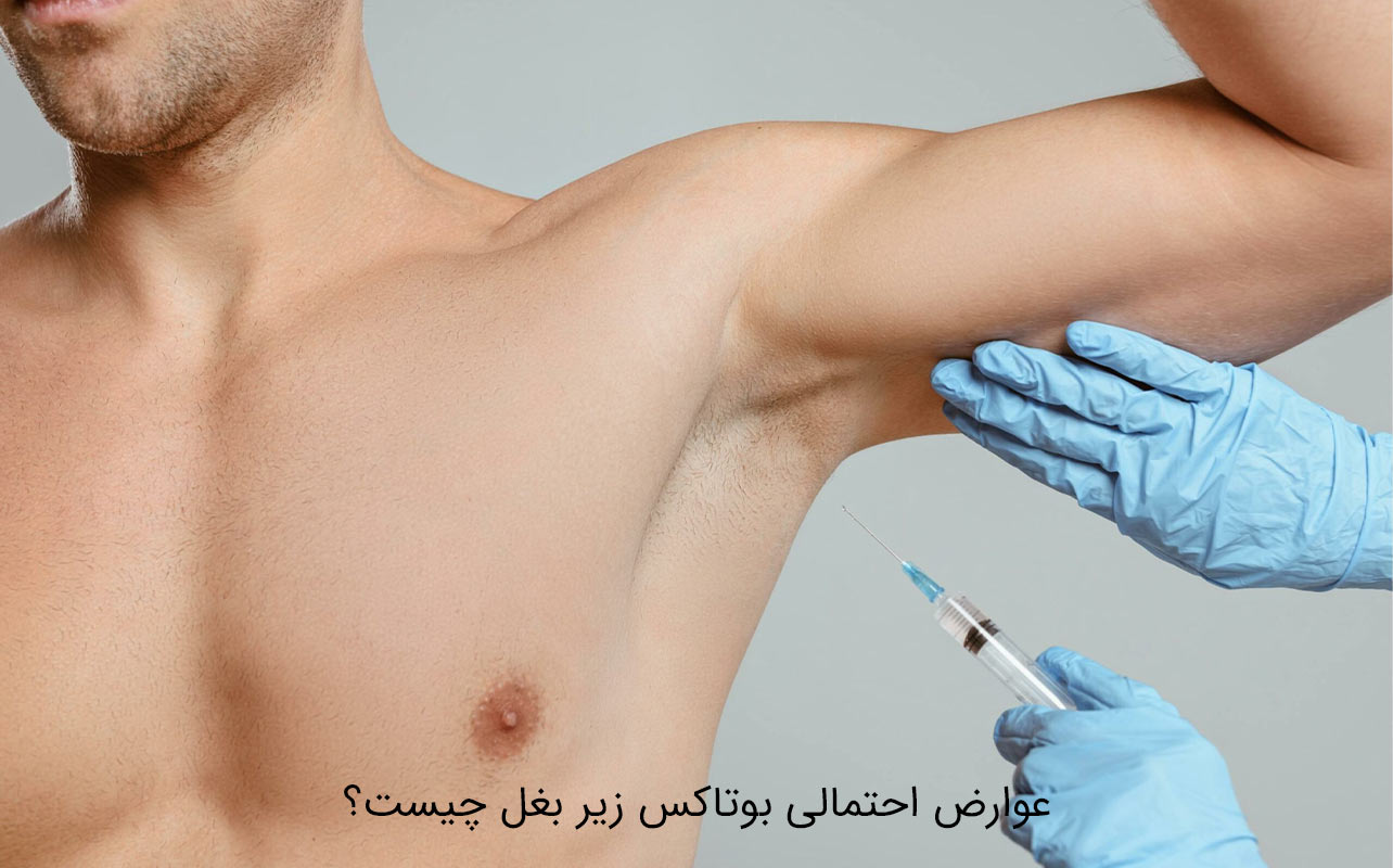 بوتاکس زیر بغل