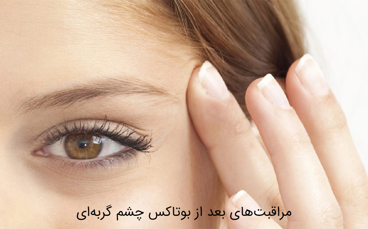 مراقبت‌های بعد از بوتاکس چشم گربه‌ای