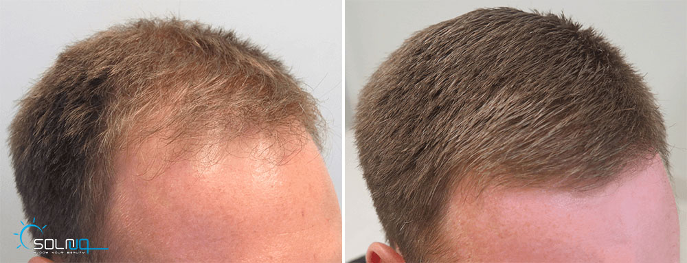 hair1
