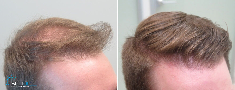 hair2