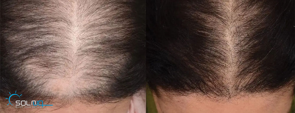 hair3
