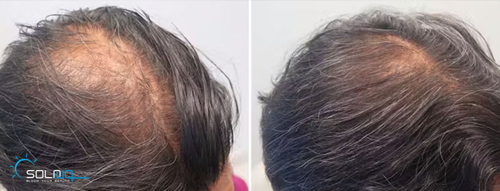 hair4