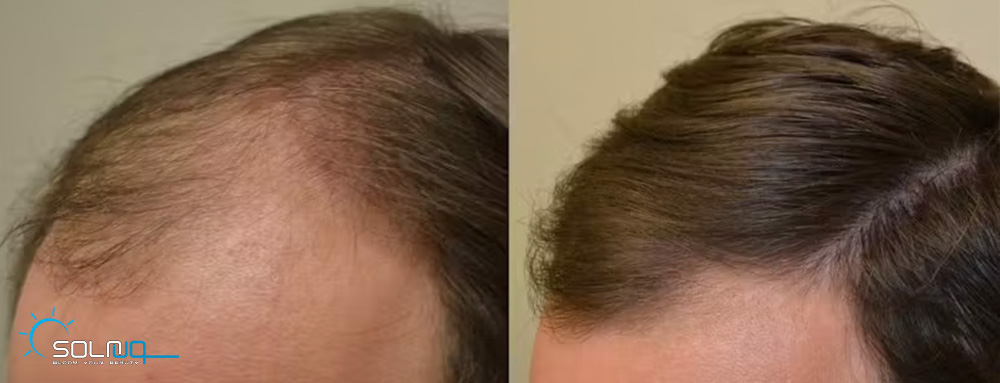 hair5