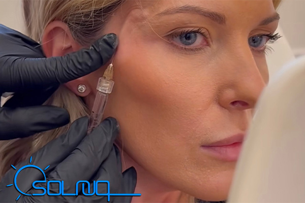 فیلر شقیقه برای بالا بردن ابرو و رفع فرورفتگی گیجگاه