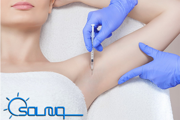 بوتاکس زیر بغل برای درمان تعریق بیش از حد