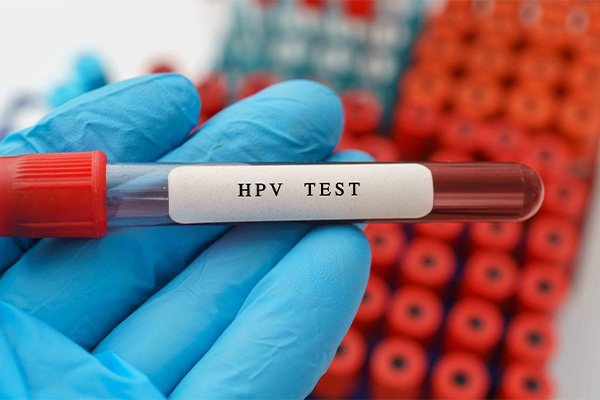 تست hpv