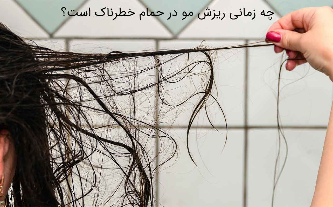 ریزش مو