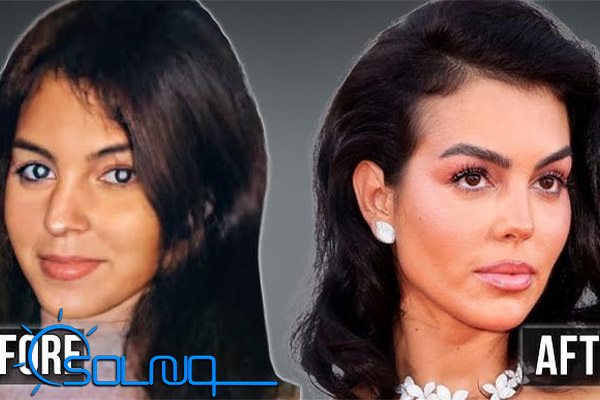 عمل های زیبایی جورجینا رودریگز