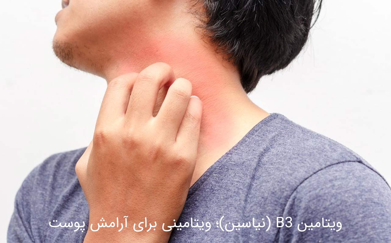 ویتامین B3