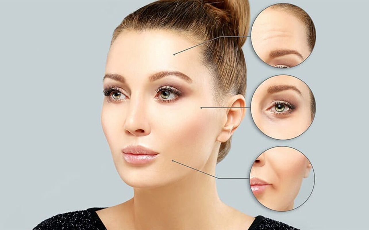 مراقبت های بعد از بوتاکس