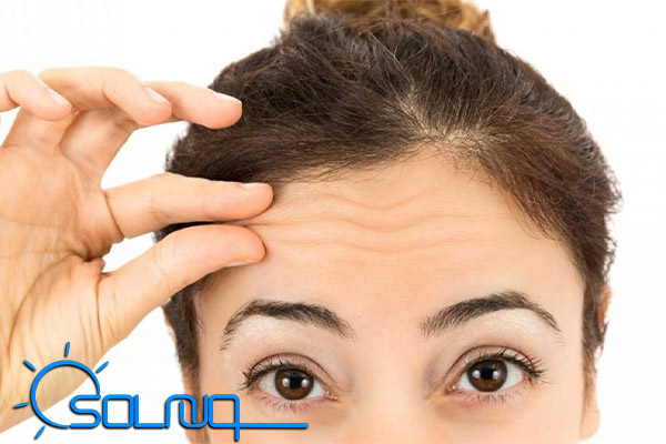 مراقبت های بعد از بوتاکس